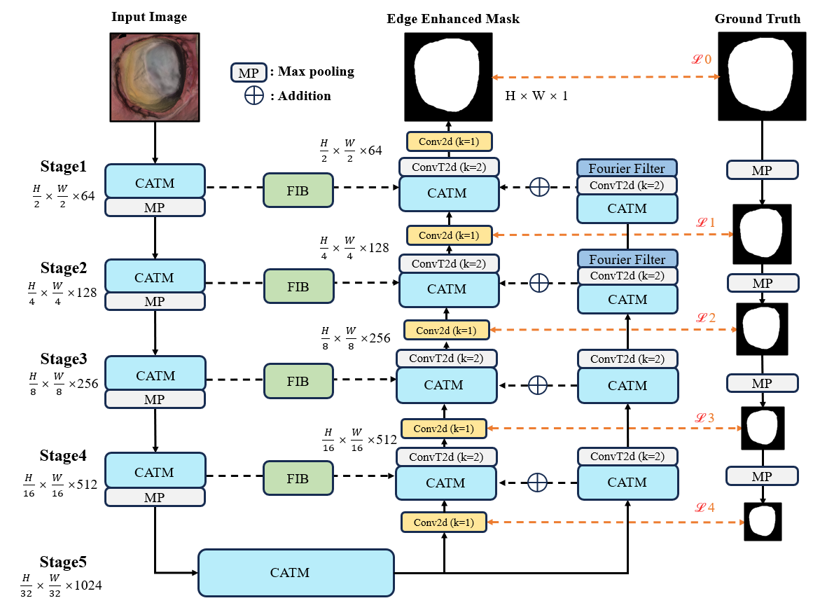 Light Weight Deep Learning for Automated 3D Dental Finish Line Detection